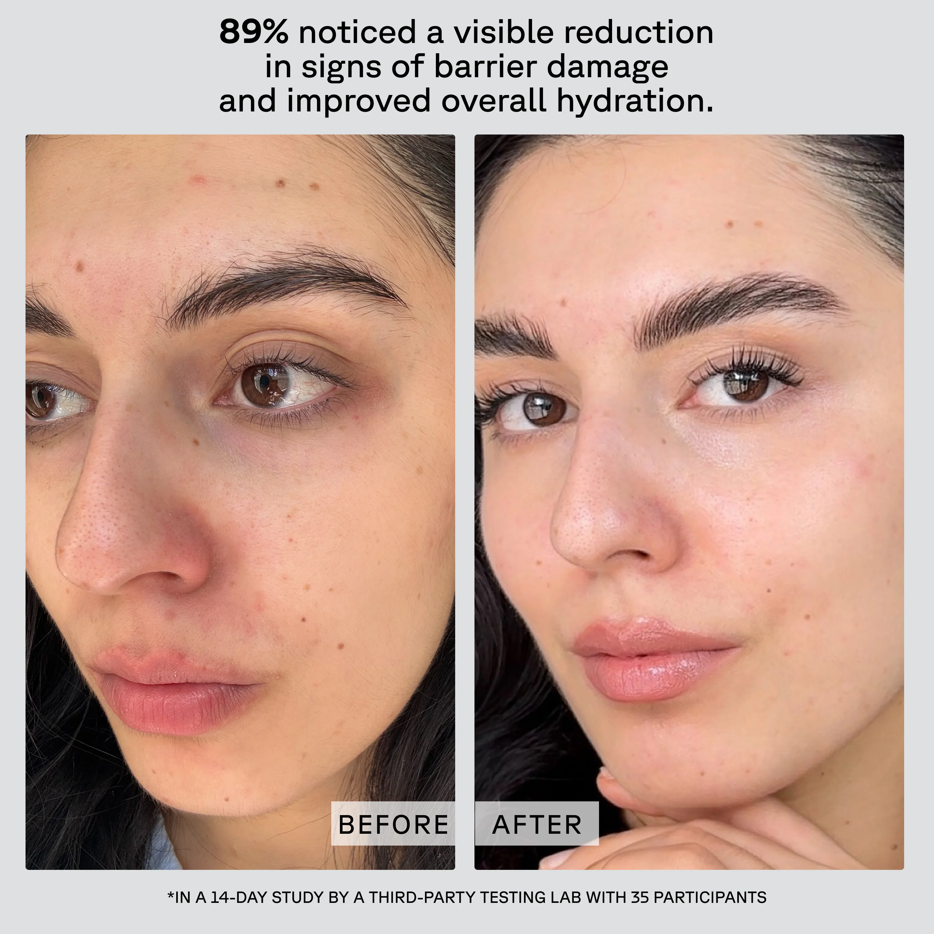 Advanced Barrier Support Moisturizer - Image 3