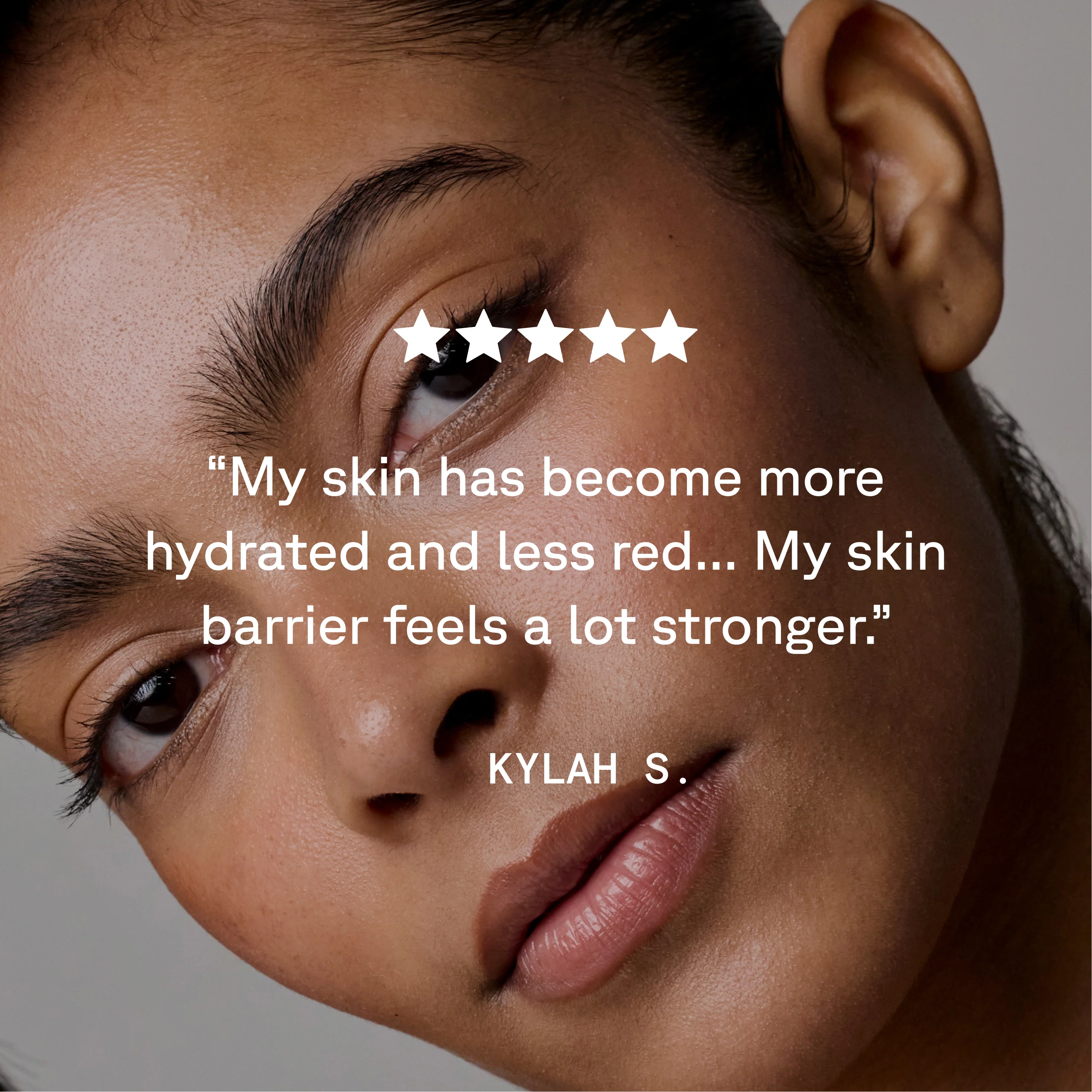 Advanced Barrier Support Moisturizer - Image 6