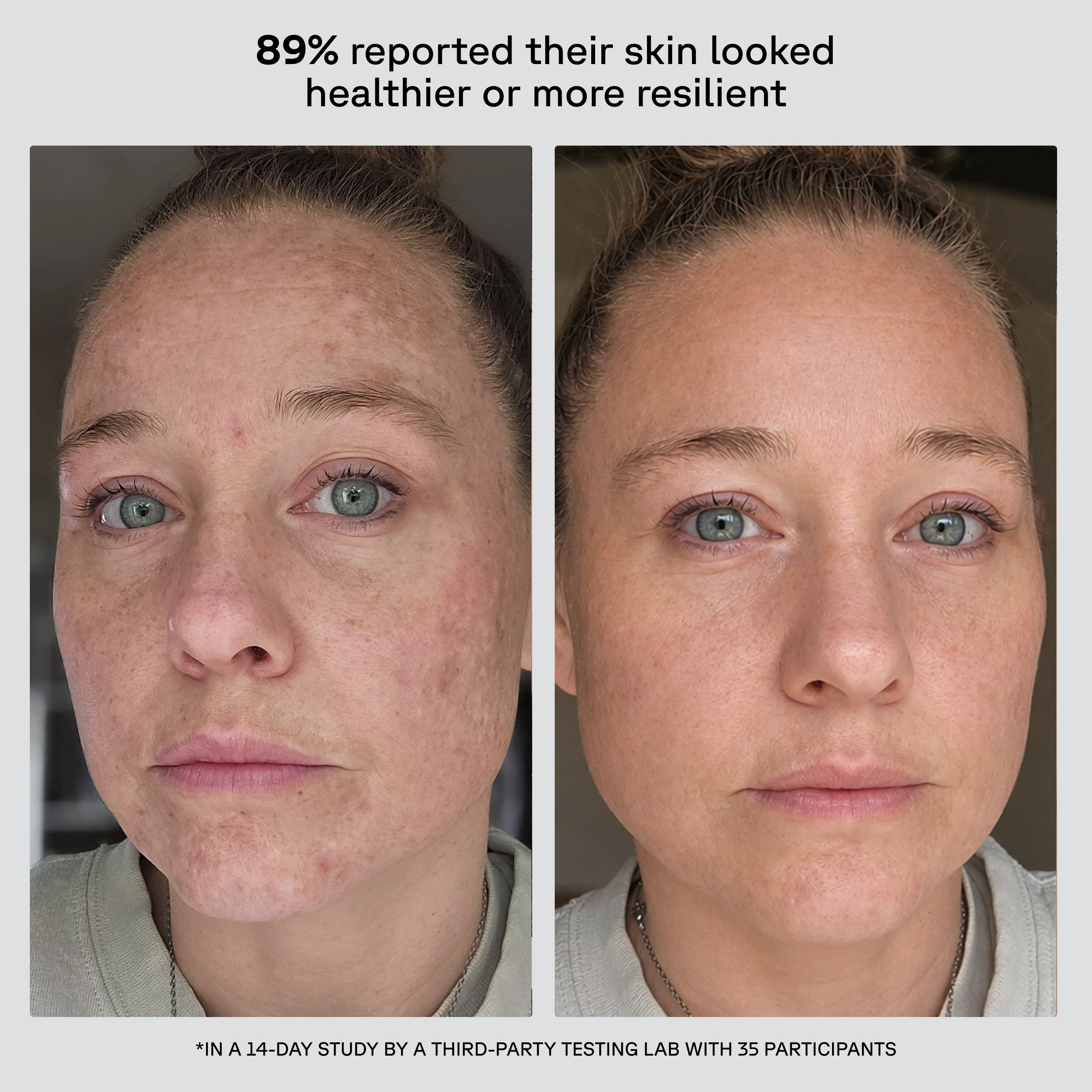 Future Fusion PM Moisturizer - Image 3